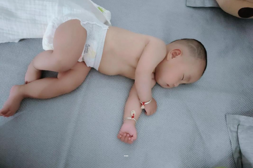 澧县孕妇前庭大腺囊肿